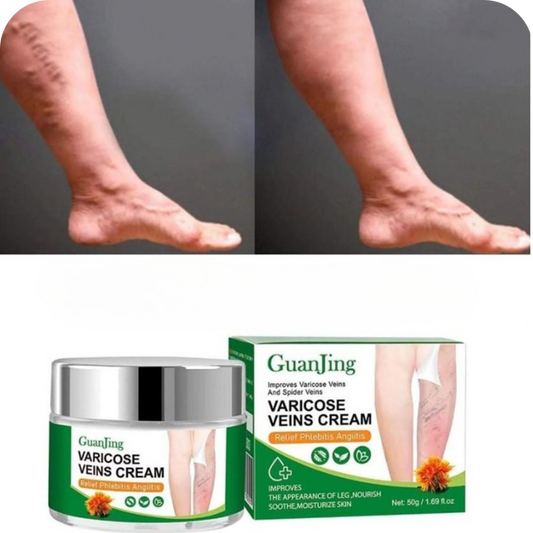 VénaPura® -Crema para Várices  35% de DESCUENTO HOY